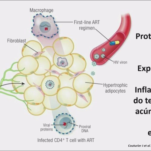 05 – Ponto de Vista 1 – Alterações metabólicas e riscos para pessoas vivendo com HIV
