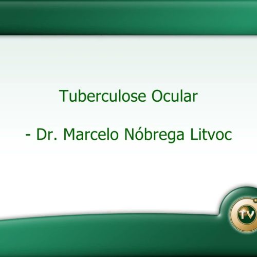128 – Tuberculose Ocular