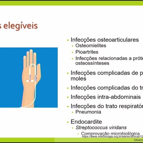 59 – Quando Indicar