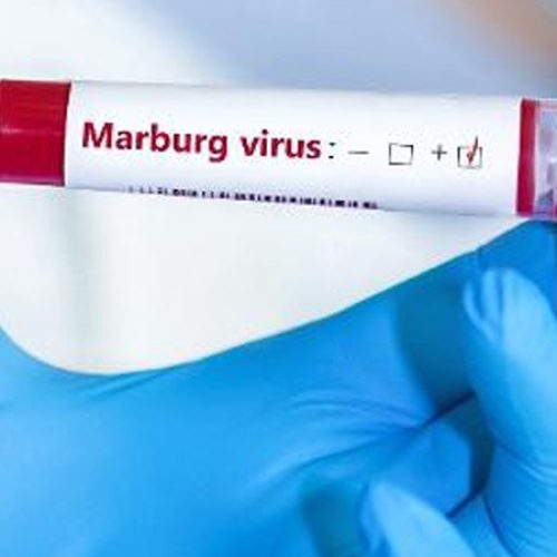 UOL – Viver Bem – Tire 6 dúvidas sobre o vírus de Marburg. Leia aqui: